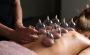 Experience Cupping Therapy in Farringdon for Pain Relief