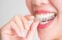 Washington, DC Invisalign