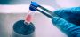 Cryopreservation Centres in Mumbai   