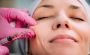 Transforming Beauty with Fillers Treatment in Andheri