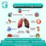 Modern Techniques Used for Cancer Surgery in Yamunanagar