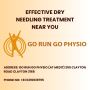 Effective Dry Needling Treatment Near You | Go Run Go Physio