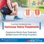 Best Varicose Veins Treatment in Hyderabad