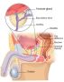 Best Prostate Cancer Surgery & Treatment in Ahmedabad 