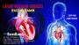 Coronary Heart Disease, Cardiovascular diseases