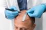 Discover Affordable Hair Transplant Cost in Allahabad 