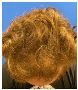 Get the Best Hair Restoration Treatment for Women
