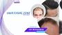 The Gentleman’s Choice Non-Surgical Hair Fixing at Bangalore