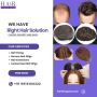 "Full Hair, Zero Surgery: Nonsurgical Hair Fixing"