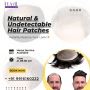 Natural & Undetectable Hair Patches- Hair Fixing Zone