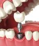 Local Orthodontist Places Near Me: A Comprehensive Directory