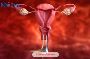 Affordable Vulvar Cancer Treatment in India with EdhaCare