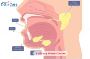Affordable Salivary Gland Cancer Treatment in India with Edh