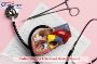Patent Ductus Arteriosus Device Closure in India – Trusted P