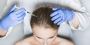 Affordable PRP Hair Treatment in Karachi - Get Results Today