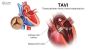 Tavi Procedure in India