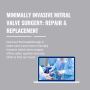 Minimally Invasive Mitral Valve Surgery Repair & Replacement