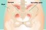Sacroiliac Pain Treatment Boise, ID