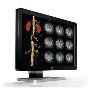 Medical Grade Monitors – Reliable and Clear Displays for Hea
