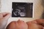 Experience the Best 4D Baby Scanning Clinic in Hitchin