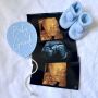 Baby Gender scan clinic Hitchin - Discover Yours