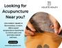 Looking For Registered Acupuncture Near You?