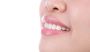 Teeth Whitening Course Online – Hollywood Whitening