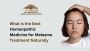 What is the Best Homeopathic Medicine for Melasma Treatment 
