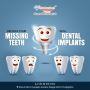 Hyderabad Smiles: Premier Dental Implants Clinic in Punjagut