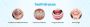 Cost Of Transparent Teeth Braces Delhi India