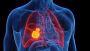 Lung Cancer Treatment in Gurgaon