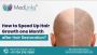 How to Speed Up Hair Growth One Month After Hair Restoration