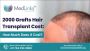 2000 Grafts Hair Transplant Cost 2024: How Much Does It Cost