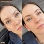 Get Glamorous with Eyelash Extensions in Elsternwick