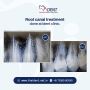 Specialized Root Canal Treatment in Belathur You Can Trust