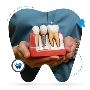 Get Affordable Dental Implants Treatment in Perth – Iluka De
