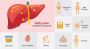 Fatty Liver Disease