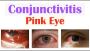 Conjunctivitis - Pink Eye