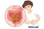 Cholera - Symptoms & causes