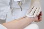 Laser Tattoo Removal – Safely Remove Unwanted Ink