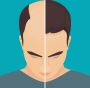 Top Hair Loss Treatment from Hair Regrowth Treatment Experts