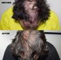 Book a Doctor on the Experts of Hair Loss Treatment WA
