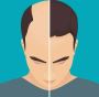 Top Hair Restoration from Hair Loss Perth Experts