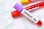 Who Should Get Cholesterol Tested?