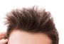 Affordable Non-Surgical Hair Solutions in Yorba Linda for Me