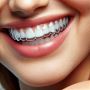 Get the Confidence You Deserve with Clear Aligners