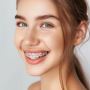 Smile Confidently with Affordable Braces Solutions