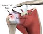 Find Leading Arthritis Doctors Near You: Expert Care with iP