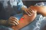 Advanced Care for Varicose Veins with Dr. Sandeep Sharma