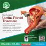 Best Treatment For Fibroids at irfacilities